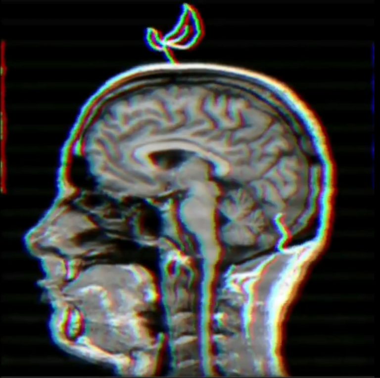 Brain signal